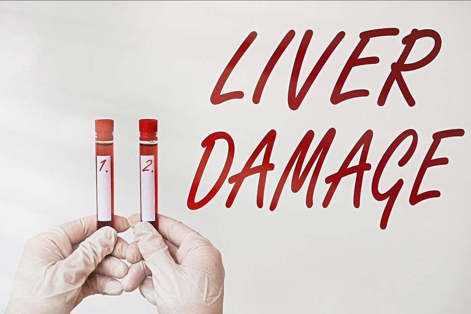 肝病专家杨丽华肝癌,杨丽华肝病专家