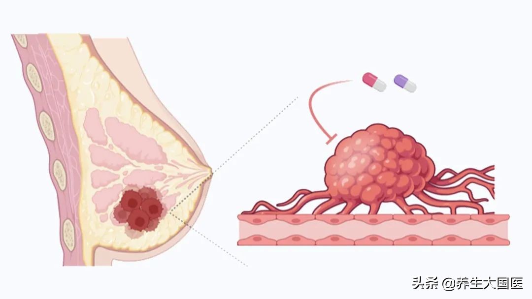 乳腺癌有救吗,乳腺癌治愈的可能性有多大