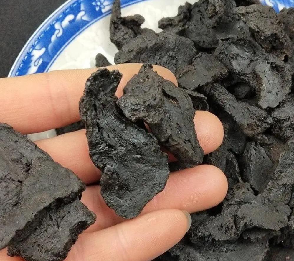 备孕肝囊肿,消除肝囊肿最好的药方