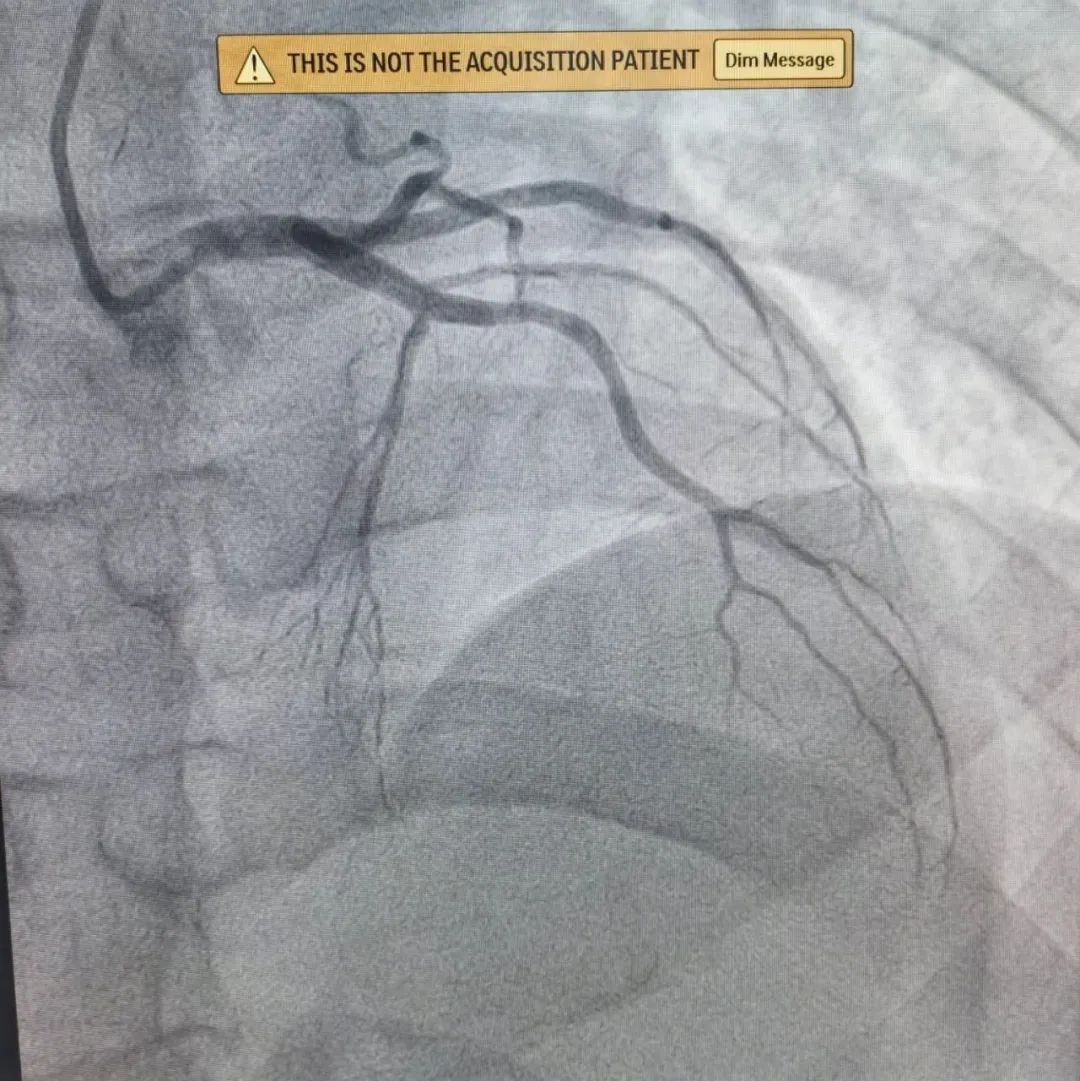 南昌最好的医院心血管内科,南昌一附院心血管内科怎么样