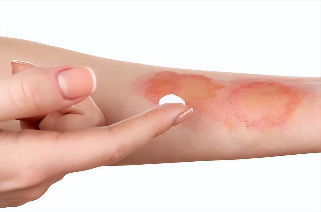 骨折后的手术疤痕怎么祛疤,儿童手术疤痕用什么祛疤药好