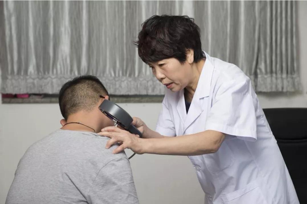 冯小刚的白癜风能治吗,冯小刚患白癜风视频