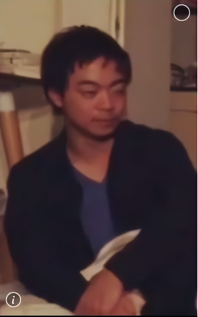 日本1米5小哥砸1600万疯狂整容增高！断骨惨烈过程吓傻网友