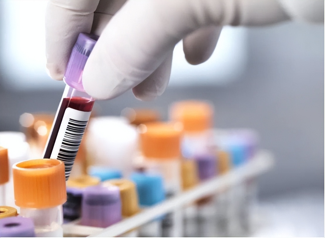 梅毒有什么注意事项,梅毒有什么要注意