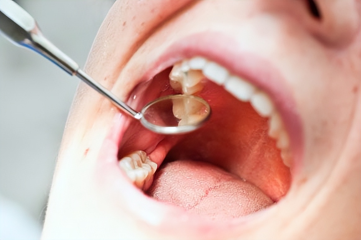 每天早上空腹喝柠檬水有什么好处,坚持喝柠檬水对皮肤有什么好处