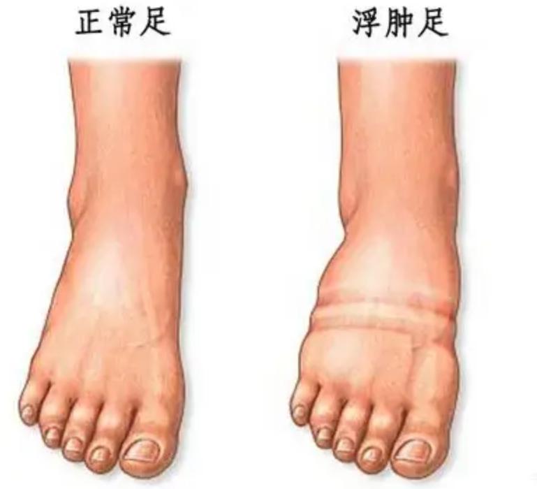 戈壁为什么禁种硒砂瓜,宁夏硒砂西瓜不让种植了吗