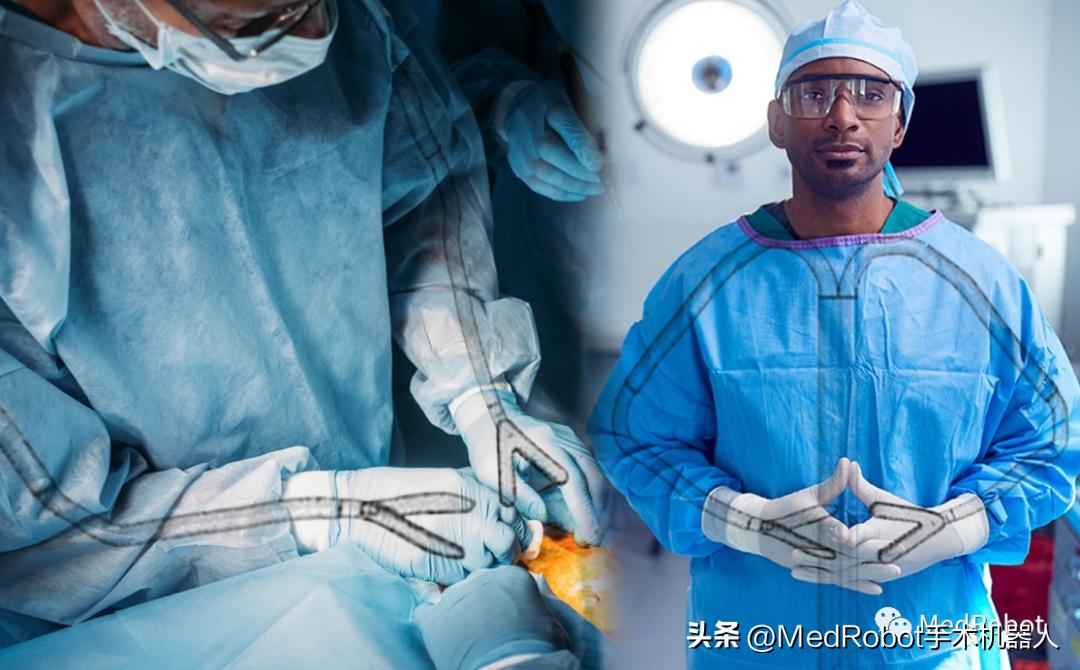 经自然腔道手术机器人Anovo|盘点