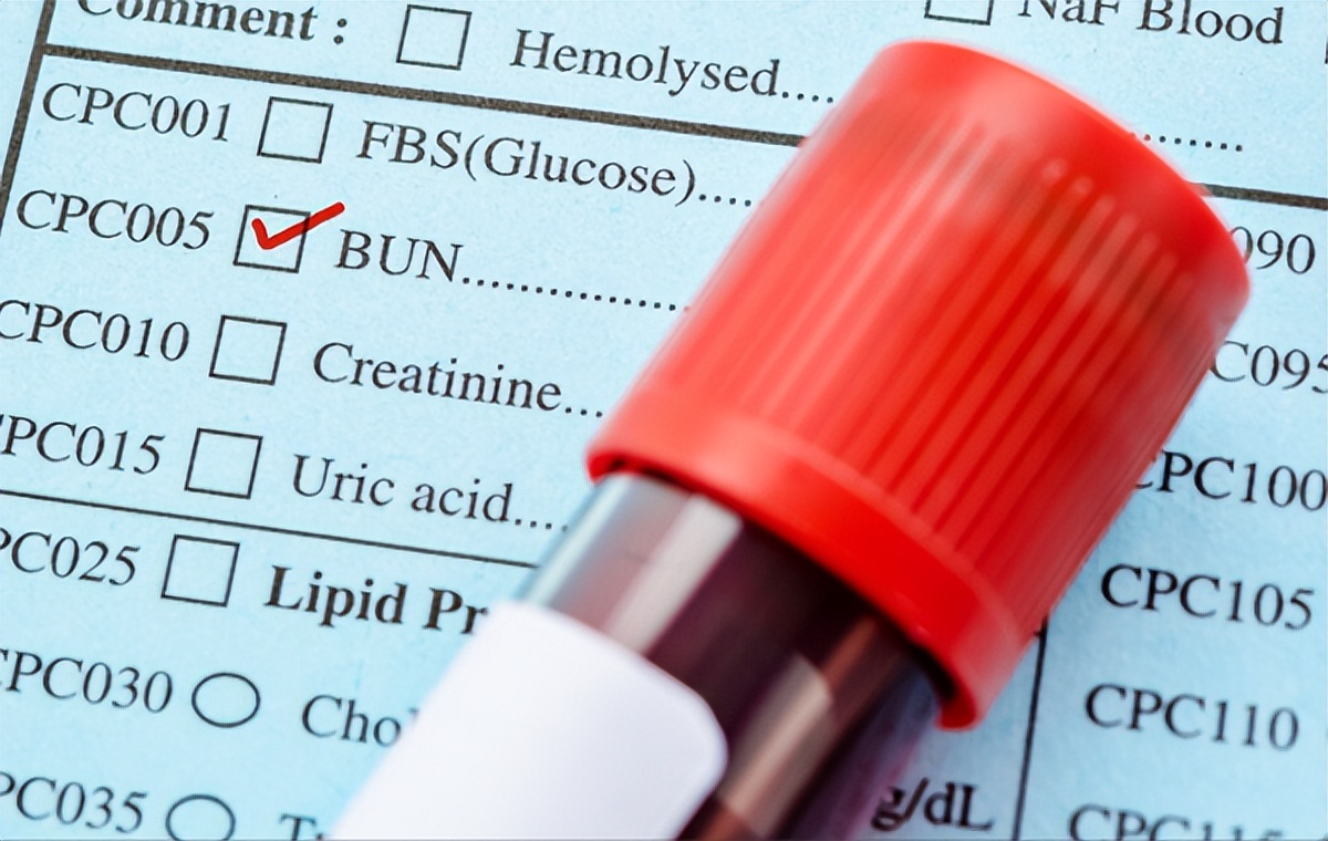 16岁男孩尿酸高是肾脏有问题吗,肥胖引起青少年尿酸高