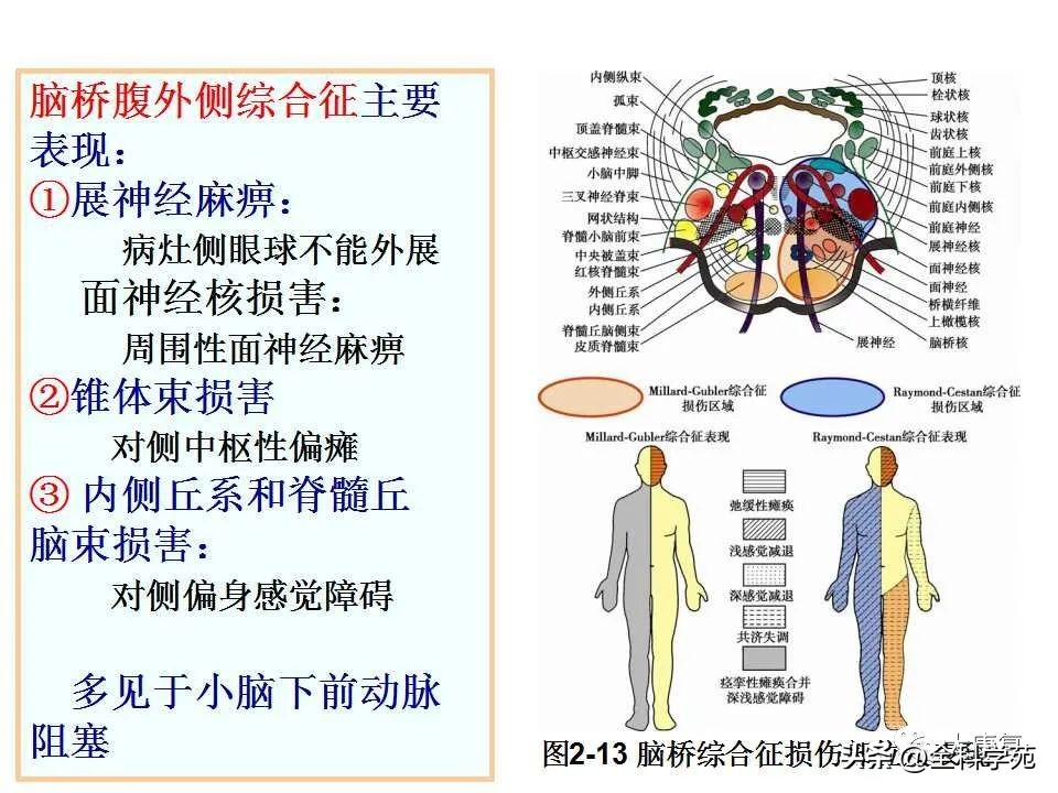 神经系统的影像与解剖定位,最全神经解剖图