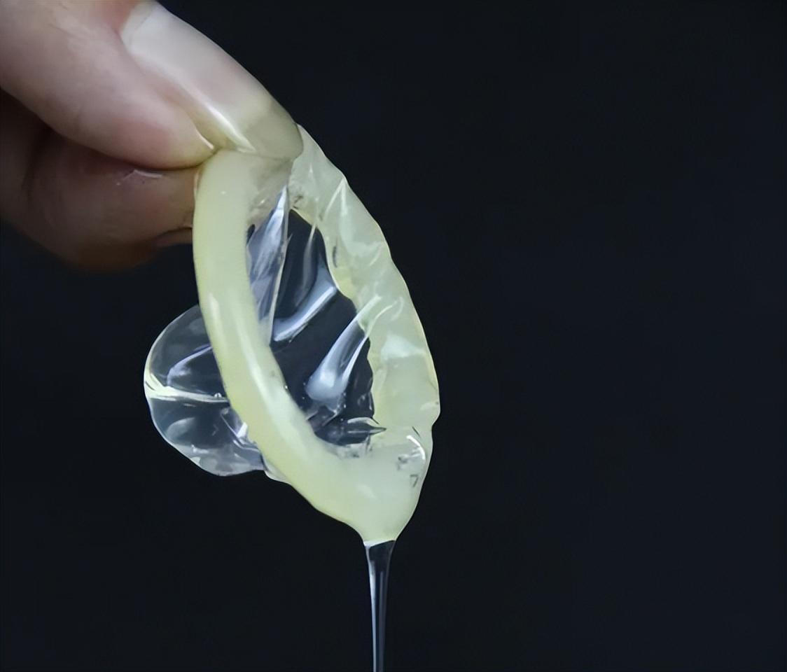 为什么安全套会过敏,为啥安全套要导热