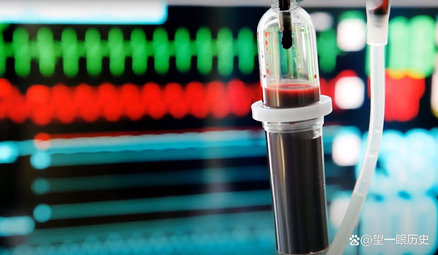 世界上最昂贵的液体，每升的血液值多少钱？告诉你答案