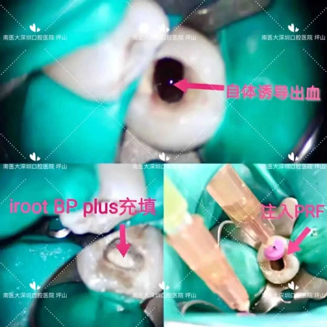 高考首日，深圳这家口腔医院笑着解出了最后“大题”：看牙难