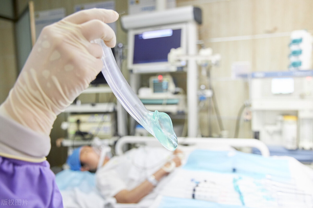 女性巨阴症有什么影响,女性巨阴症会影响生育吗