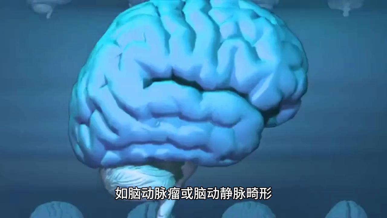 卒中治疗与预后：全面策略，重拾健康生活#卒中防控立即行动