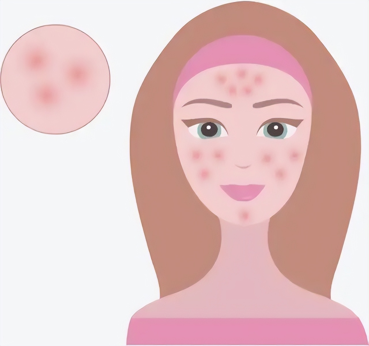 几个平时可做简单有效的医美项目,皮肤状态很好医美项目可以做哪些