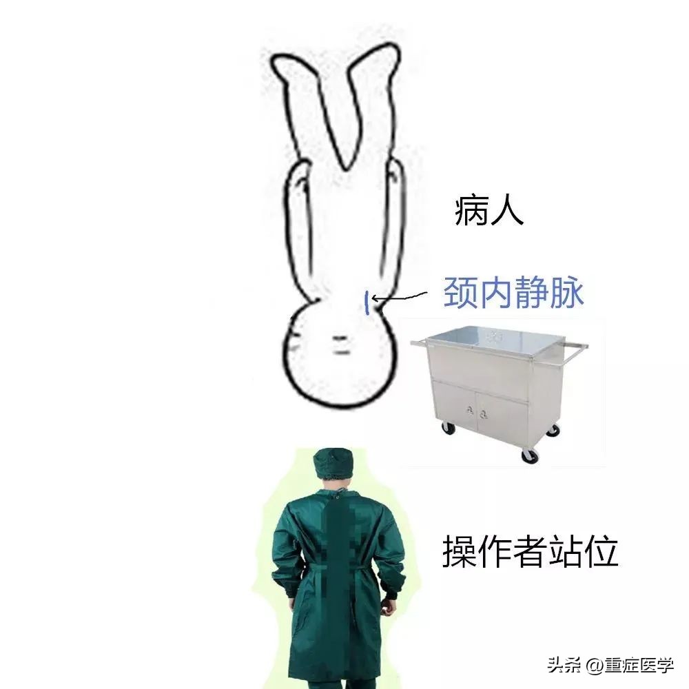 保姆级深静脉穿刺全攻略，建议收藏！