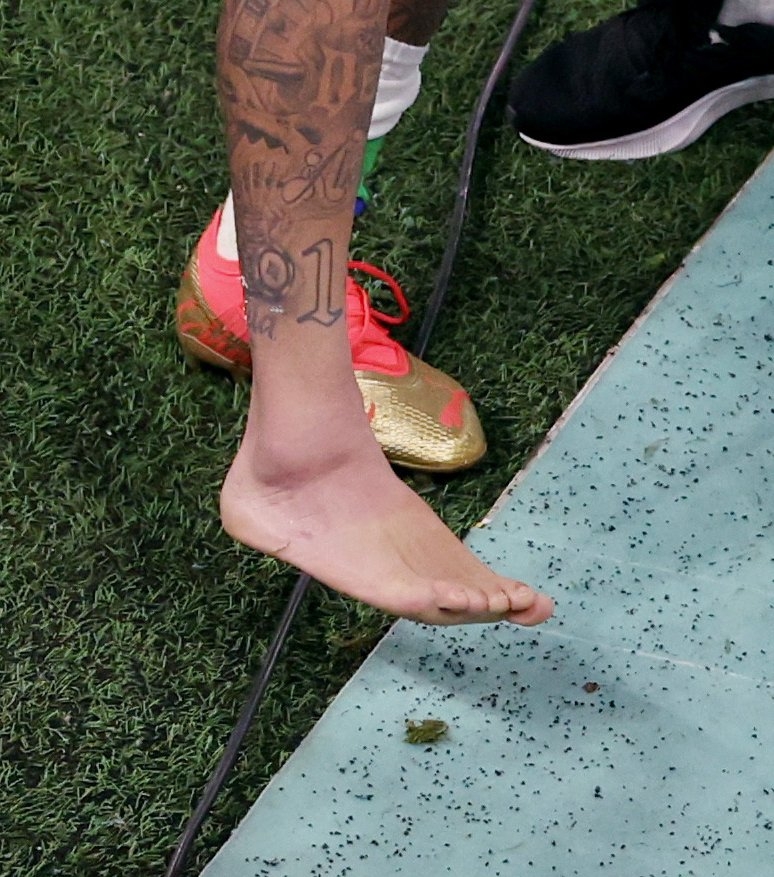 内马尔受伤后现状,内马尔受伤了下场还打吗