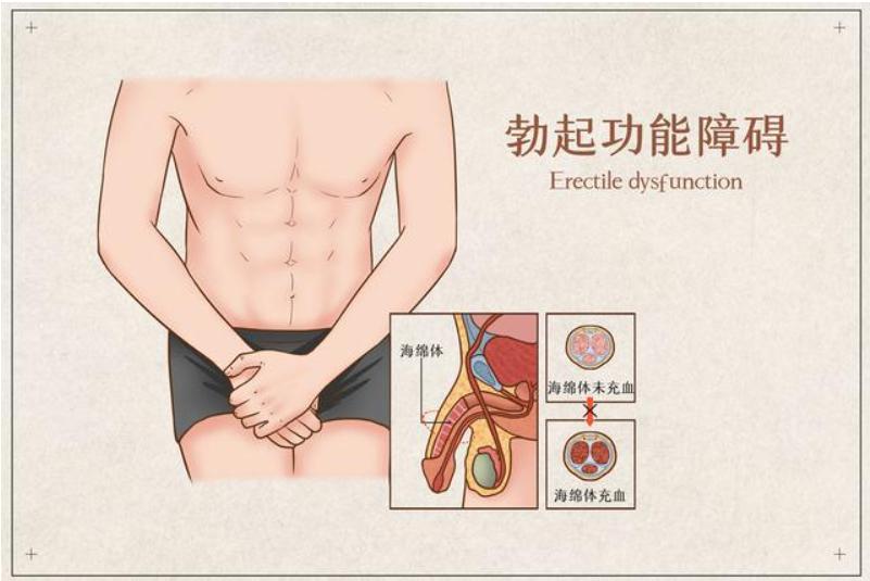 男性长期没“排精”，身体或许会出现这几种变化，早知早受益！