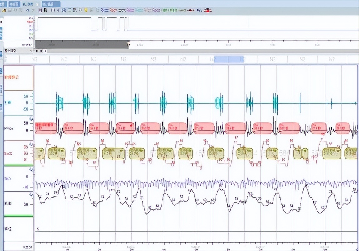 睡眠医学中心是什么科室,华北理工大学睡眠中心