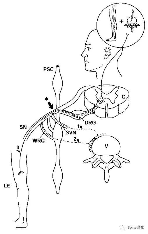 脊柱的神经支配,脊柱神经引起手臂疼痛