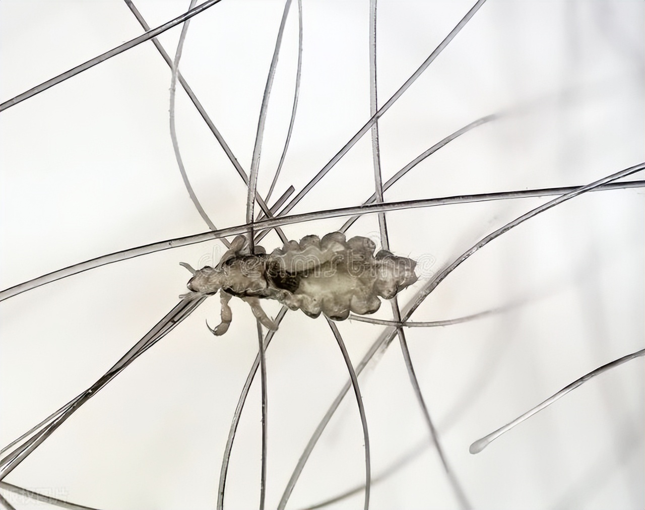 得了阴虱是什么原因,阴虱是从哪里来的什么原因造成的