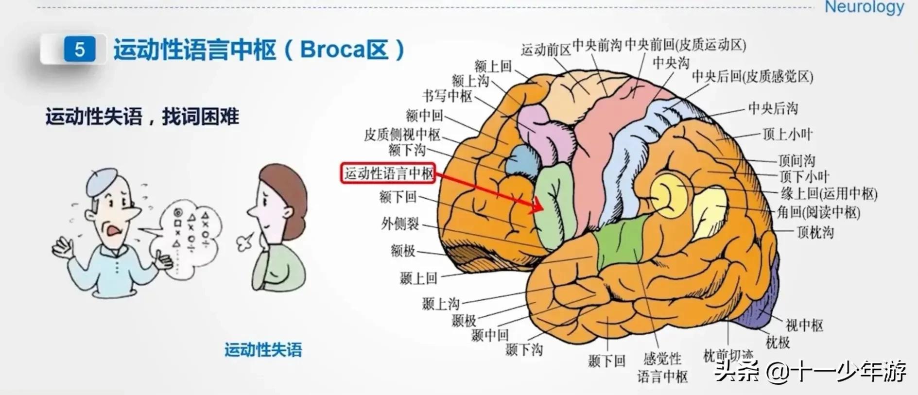 大脑的结构解剖示意图,大脑镰下疝解剖结构