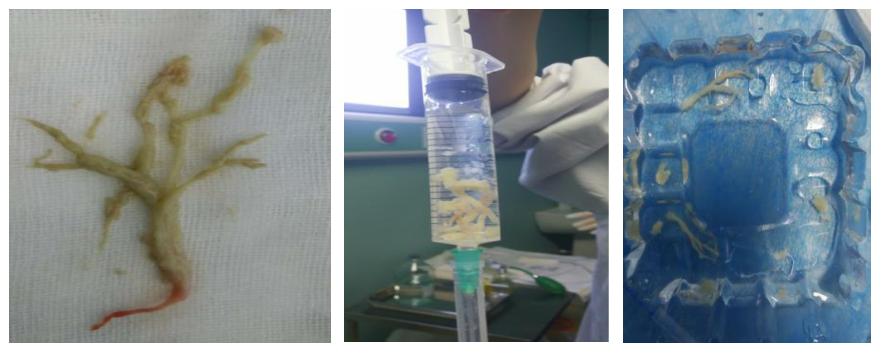 徐州市儿童医院呼吸二科,儿童呼吸介入科的设备