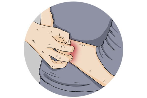 身上的阴虱是怎么来的？感染后有啥感觉？刮阴毛好，还是不刮好？