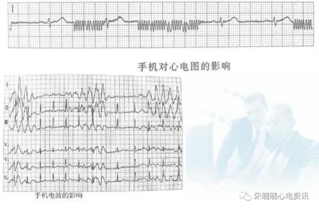 心电图机干扰信号过大的原因,心电伪差一般是指哪些干扰