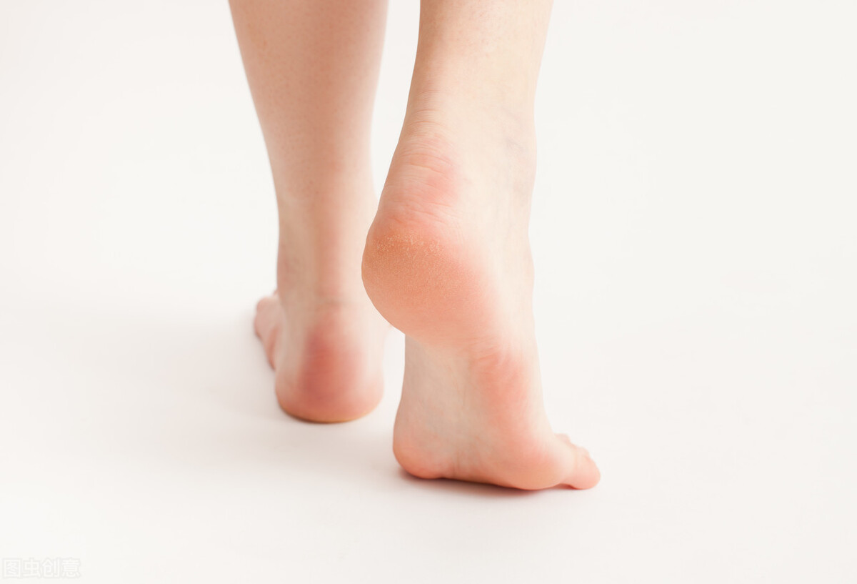 脚后跟干裂缺什么维生素,脚后跟干裂暗示什么疾病