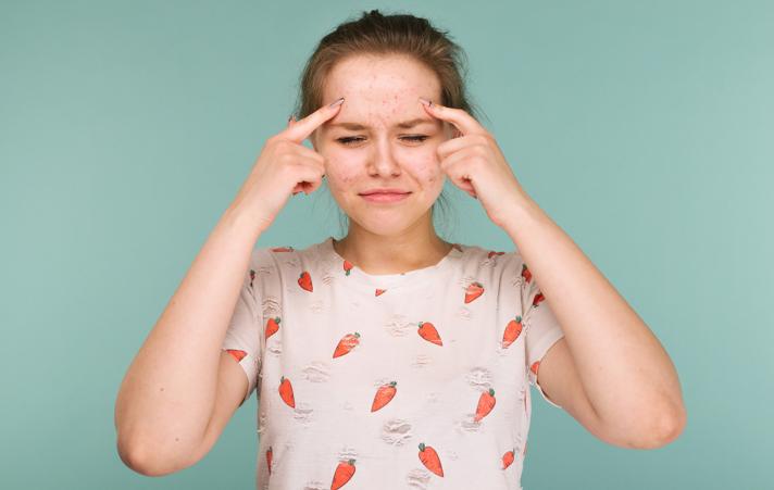 椤荤柈鍚冨紓缁碼閰告湁鐢ㄥ悧,鑴镐笂鑴撶柋鐤彲浠ュ悆寮傜淮a閰稿悧