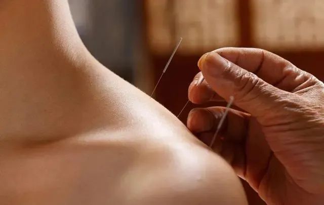 阿尔茨海默病中医治疗方法,中医治疗阿尔茨海默症的案例