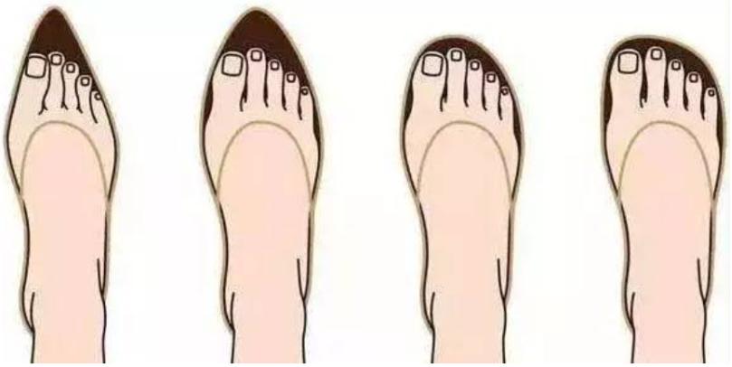 专家支招爱美女士，别让“水晶鞋”内的双脚受伤了