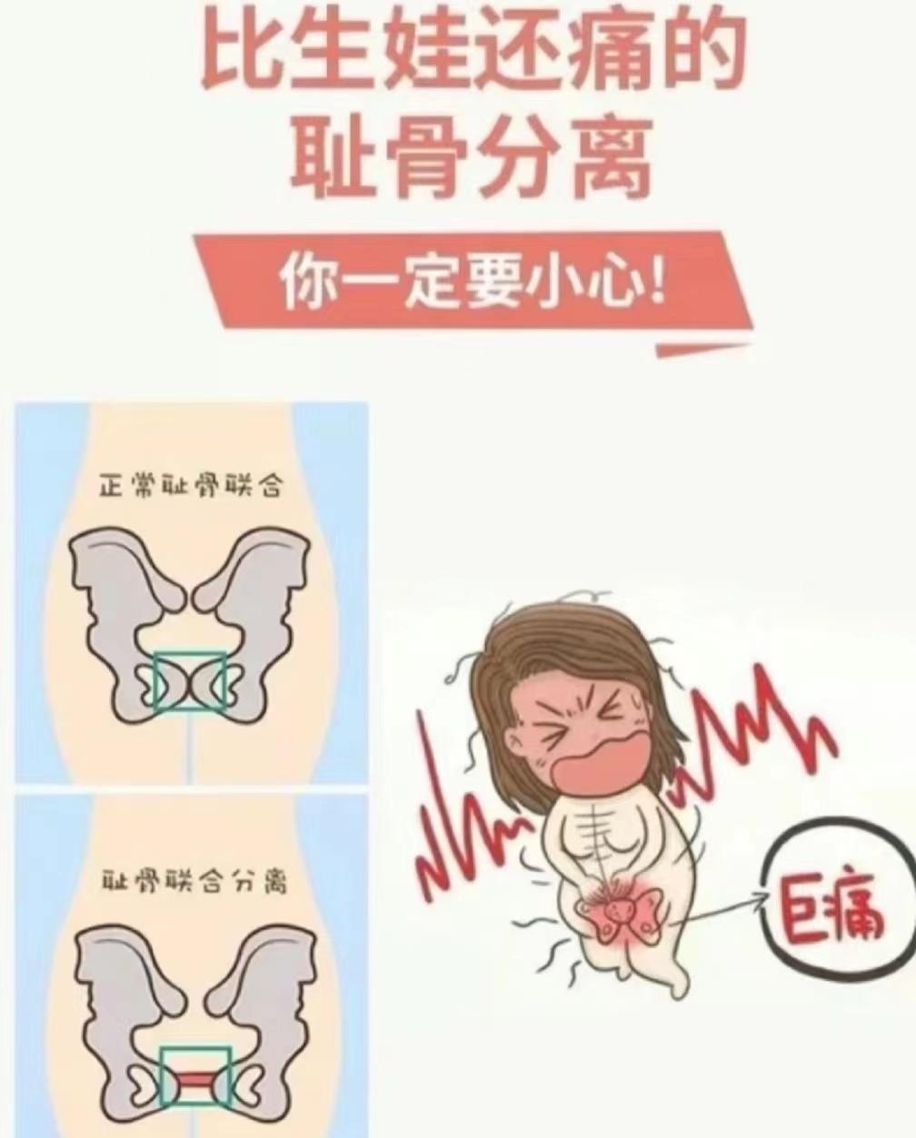 妇幼疼痛科,妇幼保健院有疼痛科吗