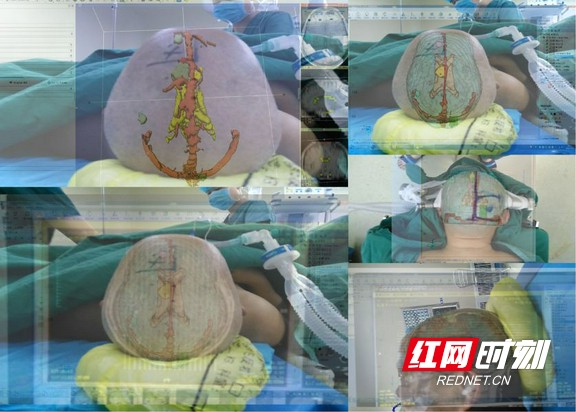 鐮ョ牶瀹炲共涔﹀啓鑽ｅ厜,鐮ョ牶瀹炲共