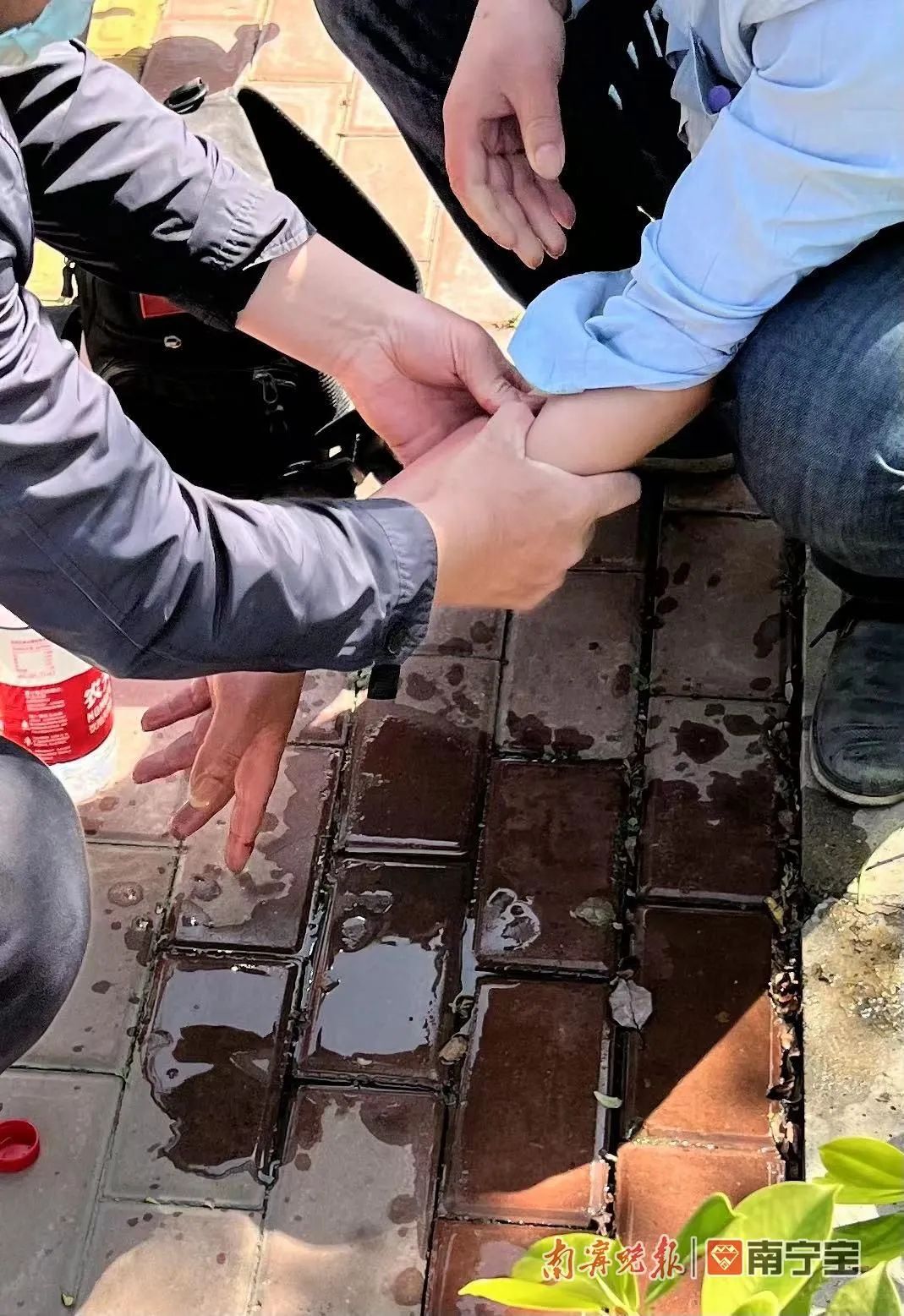 群众不小心被蛇咬伤,在山上被蛇咬伤后紧急处理办法