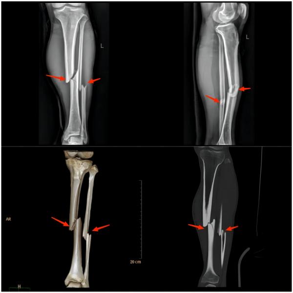 运动损伤知识科普宣传内容,关于足球运动损伤调查问卷