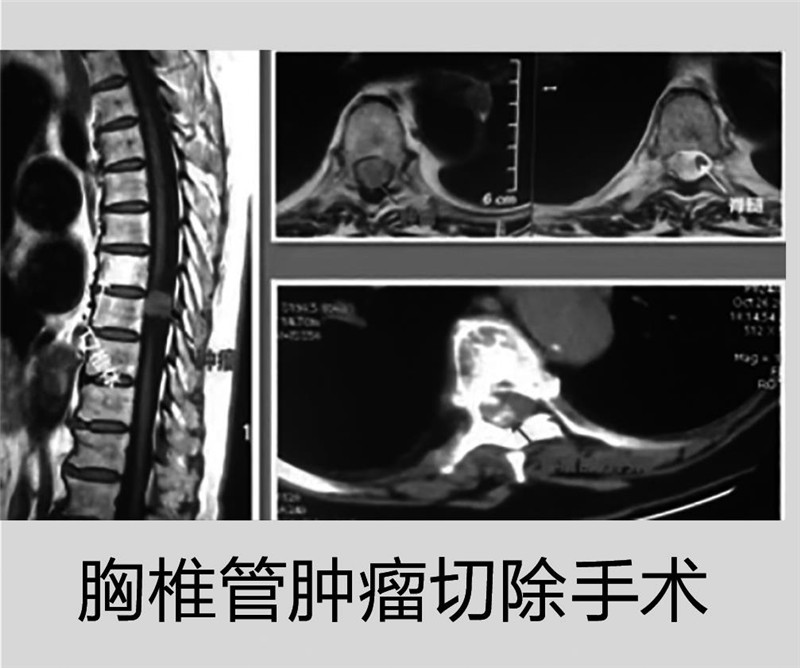 西安第五医院擅长什么,西安市第五医院外科