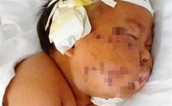 关爱产后抑郁症患者,关爱宝宝关注孕产妇健康